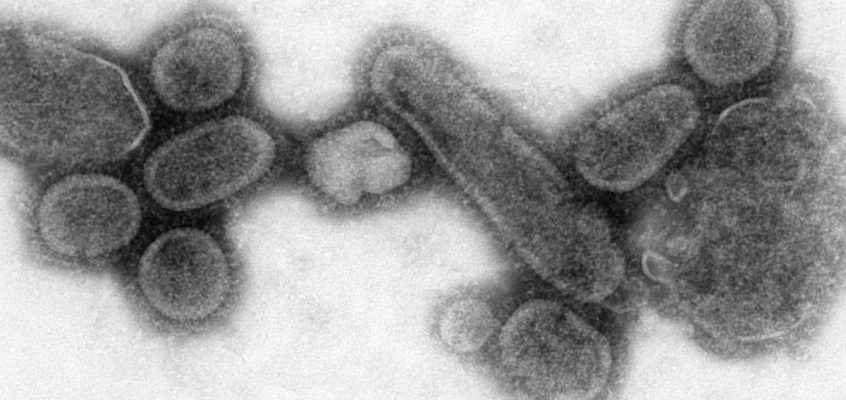 Image with electron microscope transmitting a recreated influenza virus from 1918