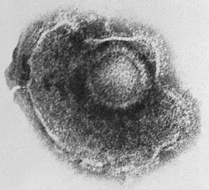 Structura virusului varicelei