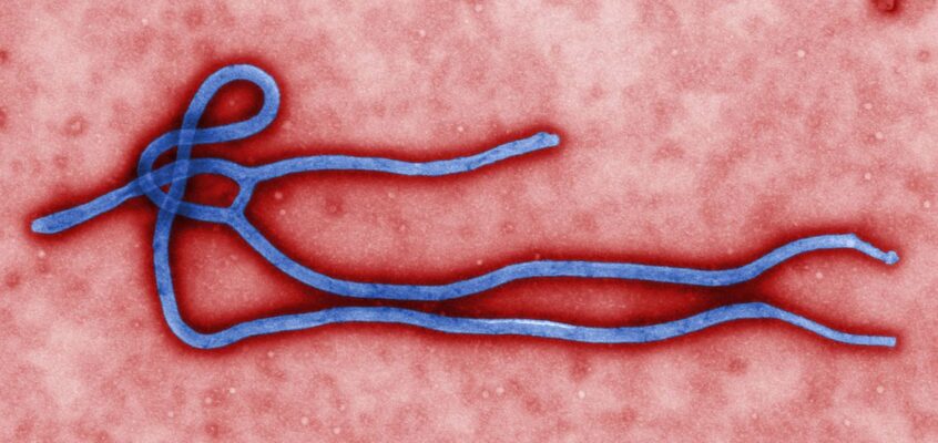 Ebola virus virion