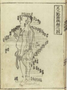 Acupunctura