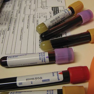 Anticoagulanți