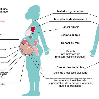 Effets des PFAS (substances per- et polyfluoroalkylées) sur la santé humaine.
