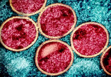Micrographie électronique à transmission colorisée de particules immatures du virus MPOX (rouge avec enveloppe virale beige) trouvées dans une cellule VERO E6 infectée (bleu sarcelle), cultivée en laboratoire. Image prise au Centre de recherche intégré du NIAID (IRF) à Fort Detrick, dans le Maryland