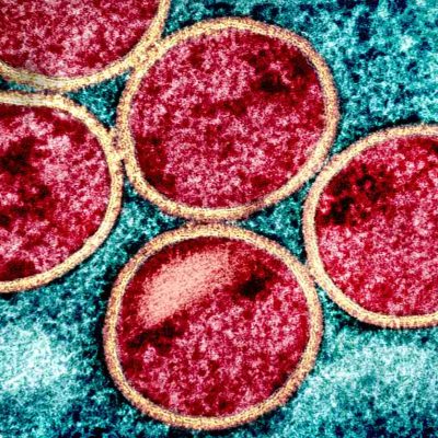 Micrographie électronique à transmission colorisée de particules immatures du virus MPOX (rouge avec enveloppe virale beige) trouvées dans une cellule VERO E6 infectée (bleu sarcelle), cultivée en laboratoire. Image prise au Centre de recherche intégré du NIAID (IRF) à Fort Detrick, dans le Maryland