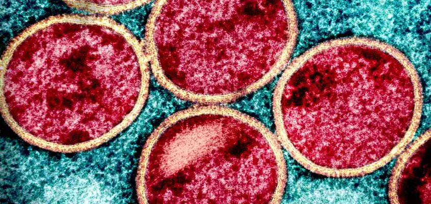 Micrographie électronique à transmission colorisée de particules immatures du virus MPOX (rouge avec enveloppe virale beige) trouvées dans une cellule VERO E6 infectée (bleu sarcelle), cultivée en laboratoire. Image prise au Centre de recherche intégré du NIAID (IRF) à Fort Detrick, dans le Maryland