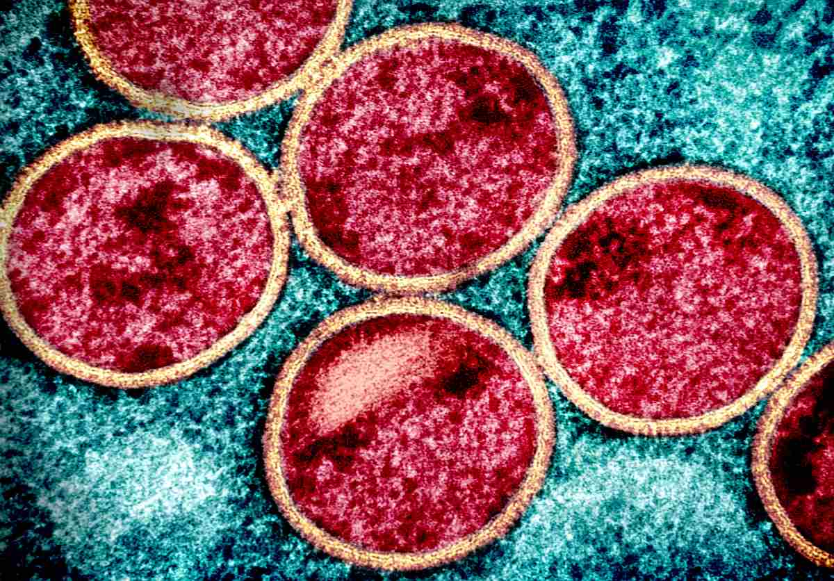 Micrographie électronique à transmission colorisée de particules immatures du virus MPOX (rouge avec enveloppe virale beige) trouvées dans une cellule VERO E6 infectée (bleu sarcelle), cultivée en laboratoire. Image prise au Centre de recherche intégré du NIAID (IRF) à Fort Detrick, dans le Maryland