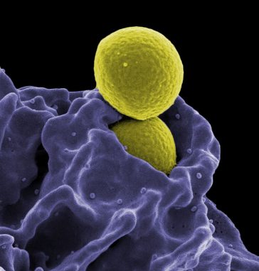 MRSA, Ingestion by Neutrophil