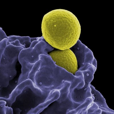 MRSA, Ingestion by Neutrophil