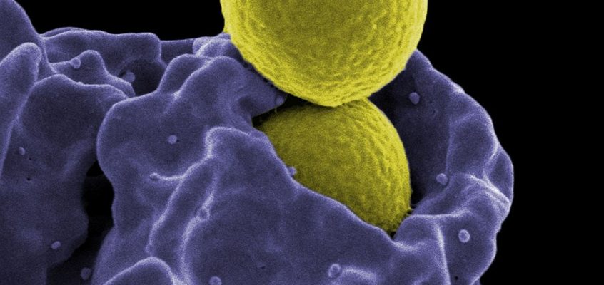 MRSA, Ingestion by Neutrophil