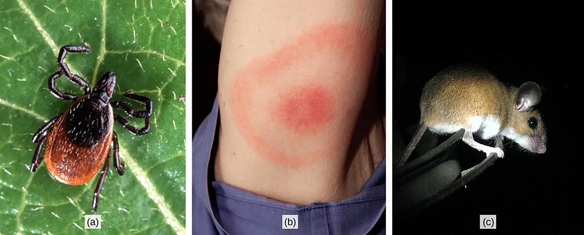 Căpușa (a) de cerb este purtătoare a bacteria care produce boala Lyme la oameni